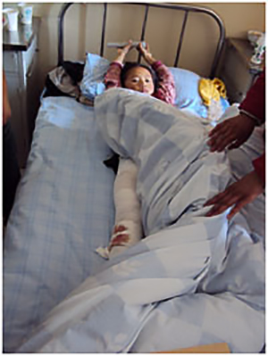 玉樹から搬送された足を怪我した女児