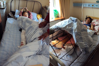 玉樹から搬送された足を怪我した女児（左）玉樹から搬送された患者
